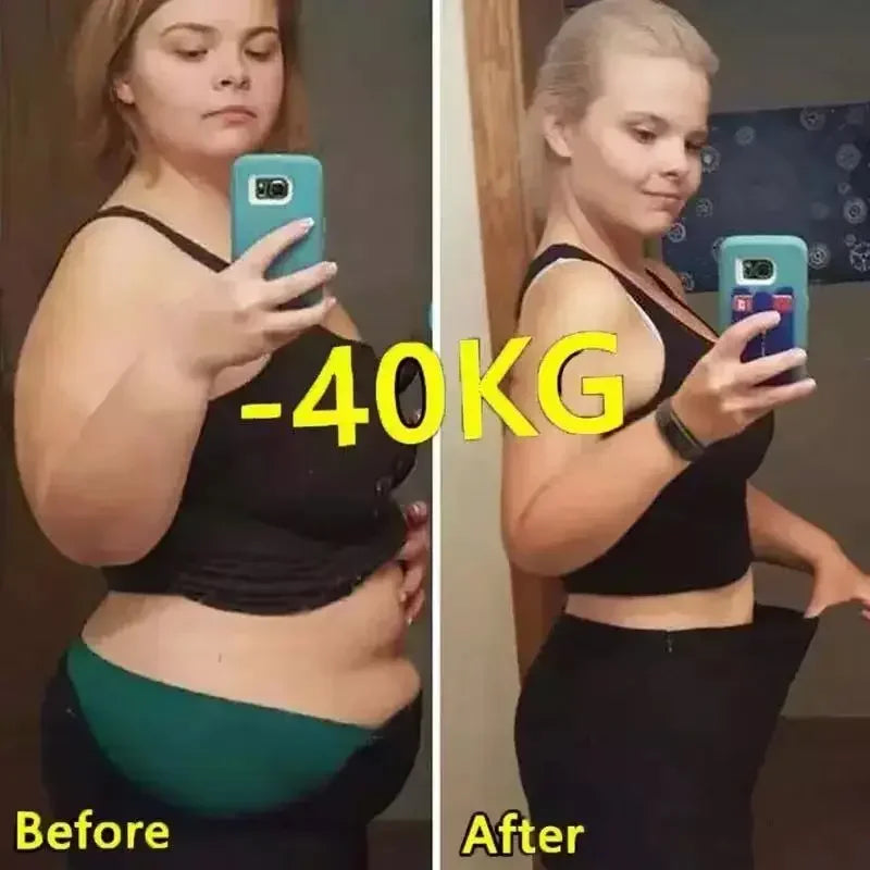 Detox and Cellulite Beauty Health