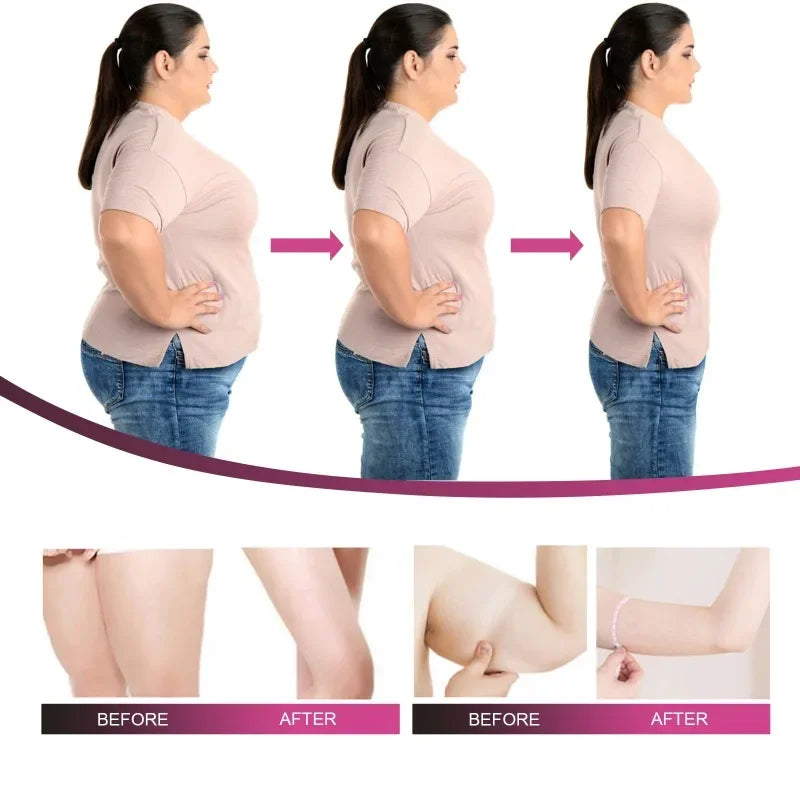 Body Slimming Cream